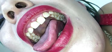 best of Fetish mouth teeth