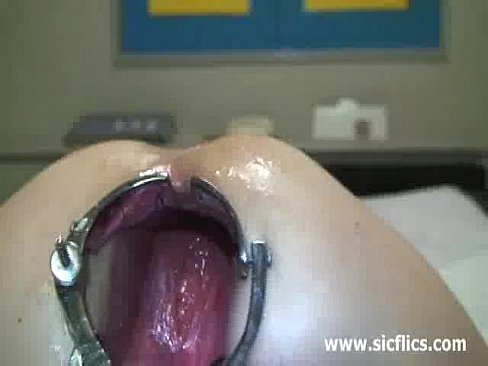 best of Anal speculum extreme
